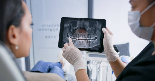Licensed Teeth Whitening service in Huron County County, MI - Smile Center Dentistry